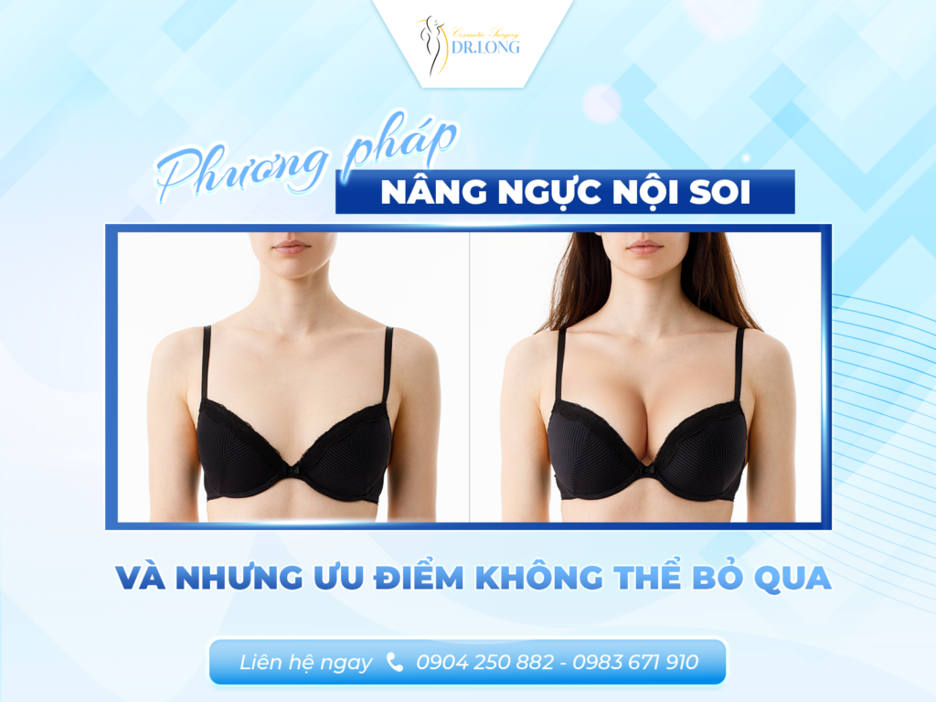 Nâng ngực nội soi